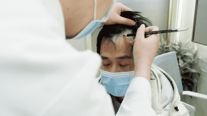 他揭开1.6亿中国男人的痛