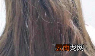 头发总是干枯毛躁怎么办 头发总是干枯毛躁原因及解决方法介绍