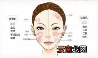 激素脸好了以后用什么样的护肤品油性皮肤 激素脸可以用什么护肤品?