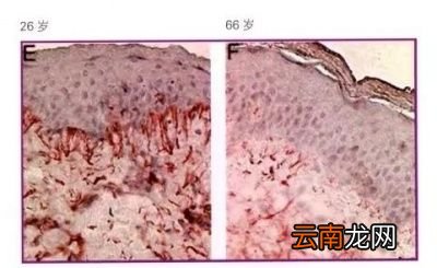 引发皮肤衰老的原因是什么