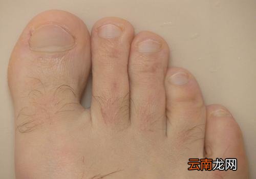 脚趾甲出现白色的东西 脚趾甲里有白色的东西是什么