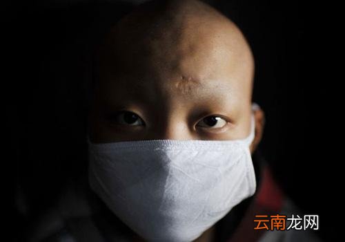 白血病分为哪几种 白血病分哪几种类型