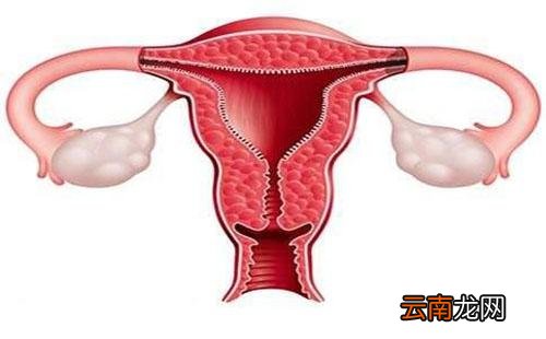 子宫内膜癌的早期症状 子宫内膜癌的早期症状能治愈吗