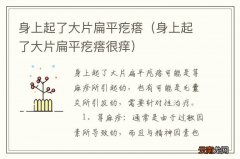 身上起了大片扁平疙瘩很痒 身上起了大片扁平疙瘩