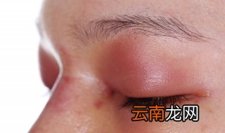有眼袋了怎么办 手术方法不同